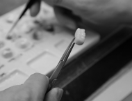 Dentallabor Carnott Detailaufnahmen